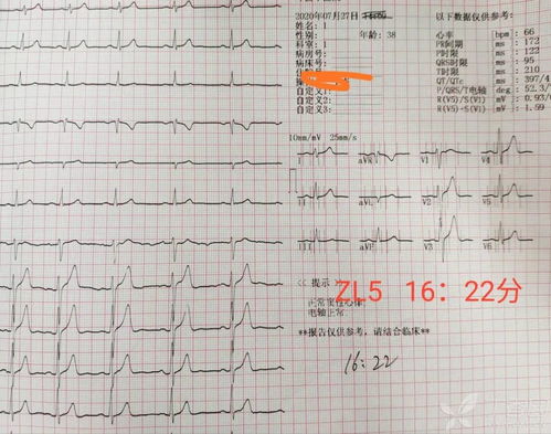 胎心监护在胎动的时候，的胎心率高于160次，正常吗？