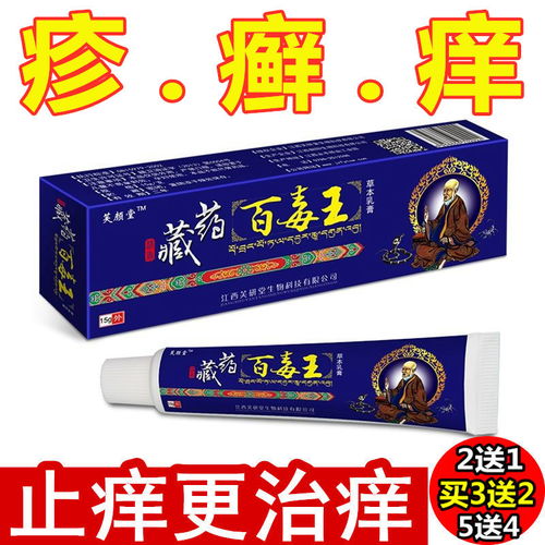 牛皮癣最好用什么药膏