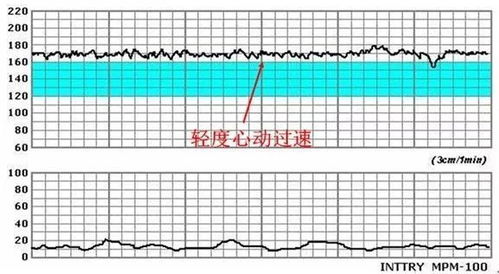 胎心监护满分10分 8分算正常吗？孕34周 感谢你