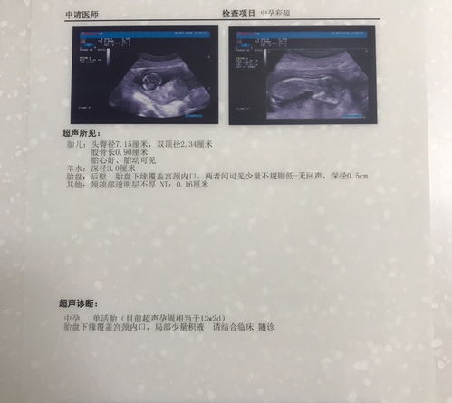 怀孕偶然有褐色分泌物怎么回事