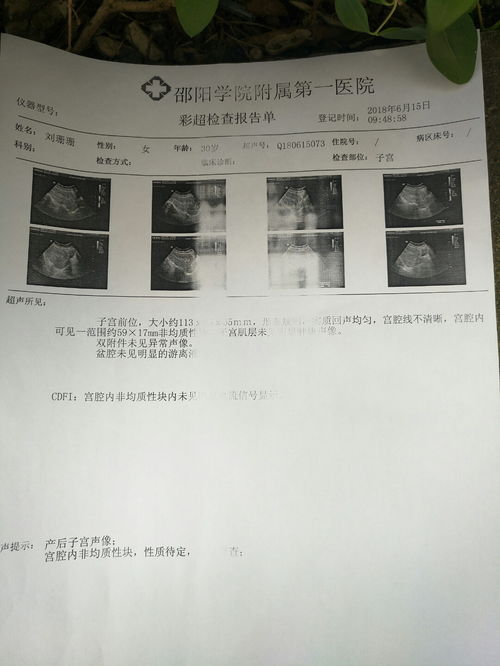 孕前检查会查出流过产