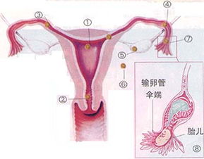 宫颈妊娠是什么意思图片