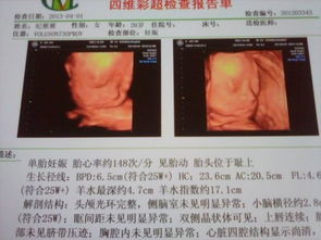 怀孕多少周可以做四维彩超？