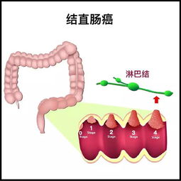 癌症误诊知道什么叫生死