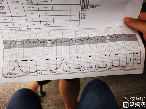 胎心监护满分10分 8分算正常吗？孕34周 感谢你