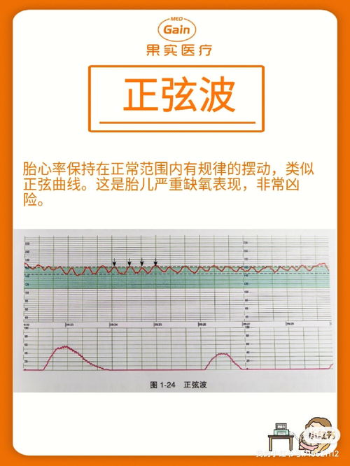 怀孕三个月胎儿心率161一分钟是不是表示缺氧吗？