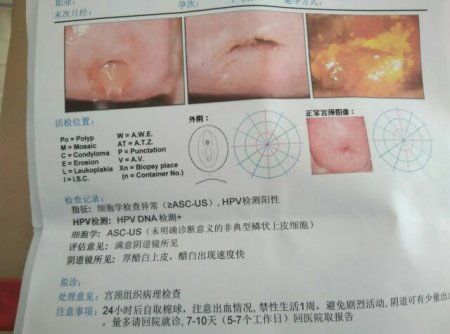 petct检查需要空腹吗