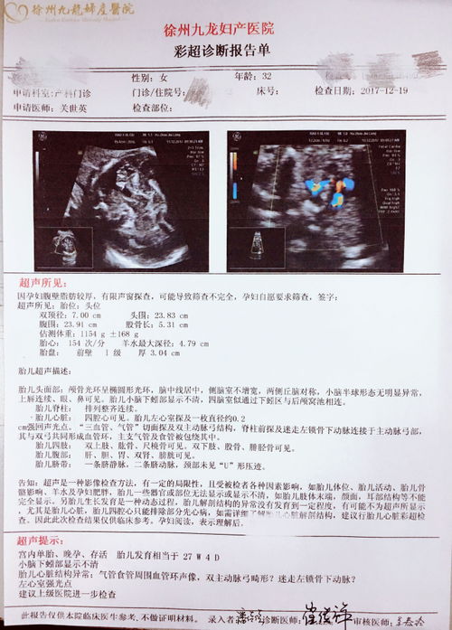 怀孕四维彩超说胎儿心脏有小点是怎么回事