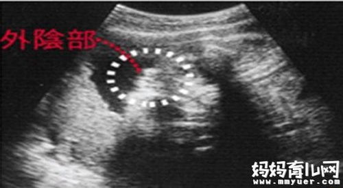 怀孕五个月了宝宝在肚子里心跳频率多少算正常