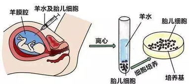 羊水培养失败怎么办呢