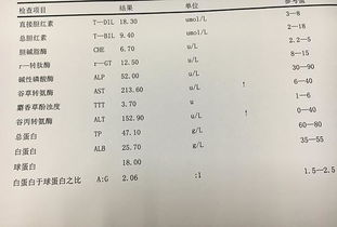 我的谷丙转氨酶75了要紧吗?