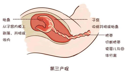 如何判断私密有没有炎症