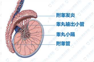 附睾炎一般多久能消肿