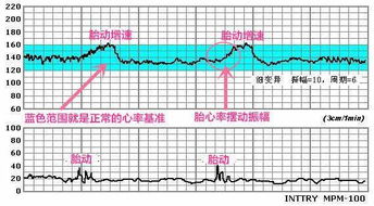 胎儿心率一分钟161属于正常吗