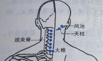 艾灸能治好颈椎病吗