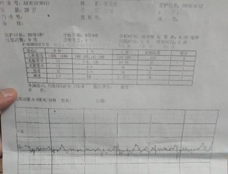 胎心动多少次为正常?