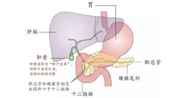 胆结石喝奶茶有影响吗