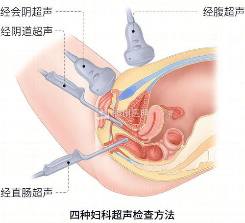 为什么两次B超的结果不一样呢？