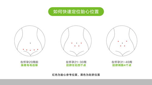 胎心监护如何快速通过检查