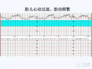 胎心出现异常的表现及原因是什么呢？