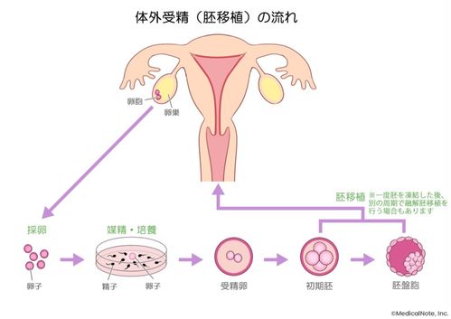 宫寒可以人工受孕吗?