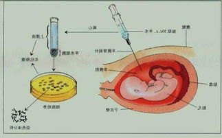 孕妇唐氏筛查的目的是什么意思