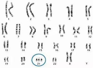 羊穿18号染色体异常