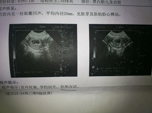 大概6周，B超检查，孕囊1.8CM 无胚芽和卵黄囊