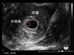 受孕几周可以看到孕黄囊