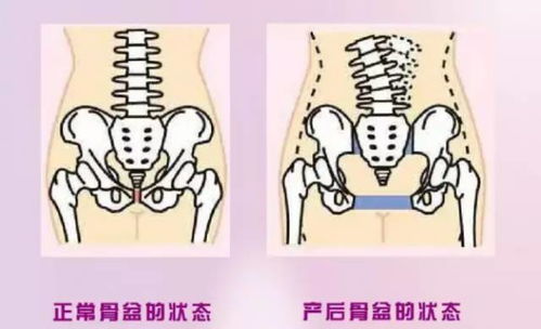 佛山市一医院做盆底康复多少钱