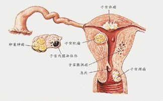 分泌物拉丝是卵泡成熟吗