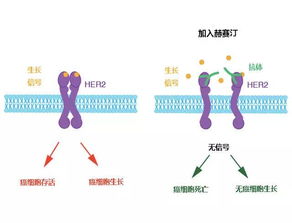 患了乳腺癌如何面对人生