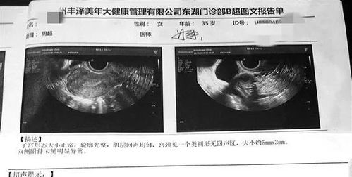 宫外孕怎么能查出来了?