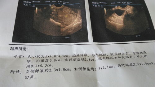 我的卵泡达到了19X22还会破吗