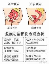 产后健身什么时候最好