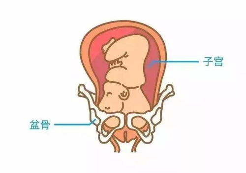 孕晚期胎儿入盆孕妇会感到轻松吗视频