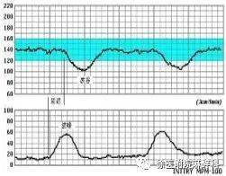 胎心异常的原因是什么意思