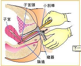 人工受孕前期需要准备什么