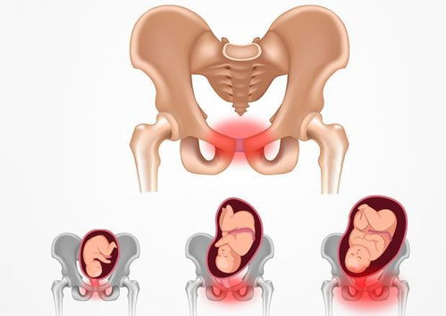 孕九个月耻骨还有下身有点疼是怎么回事