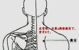 贴三伏贴后老觉得痒