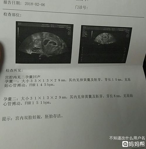 妊娠囊大小与孕周