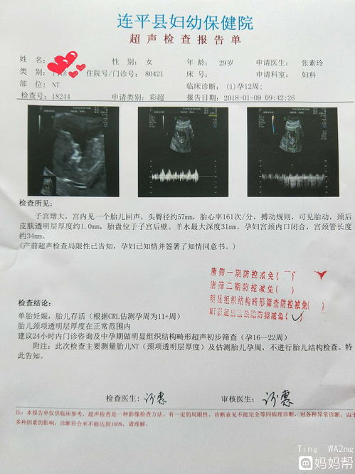 产检nt是什么