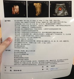 怀孕21周可以做四维吗视频