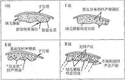 32周胎盘成熟度2级是什么意思