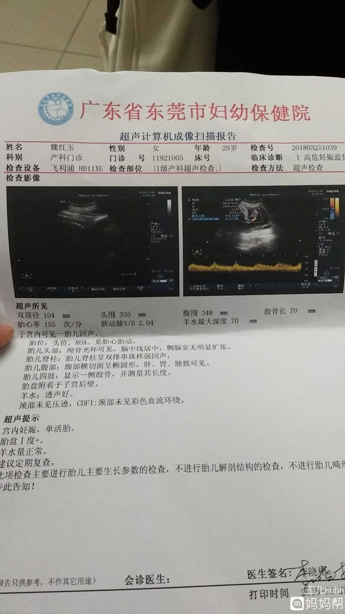 30周双顶径正常值表