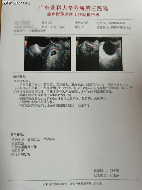 早期唐筛和nt的报告多久才能领到结果