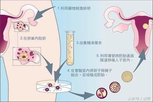 求这个视频3D动画演示婴儿从受孕到诞生全过程的背景音乐有网址试听