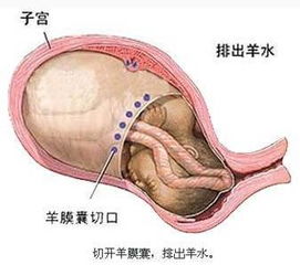 胎儿镜检查是什么检查