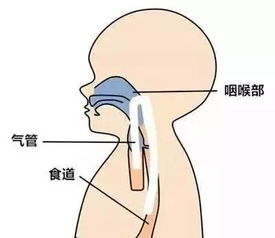 瓶喂如何预防呛奶