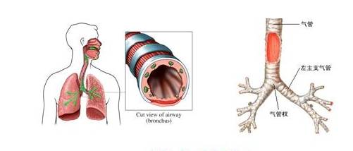 气管炎的症状